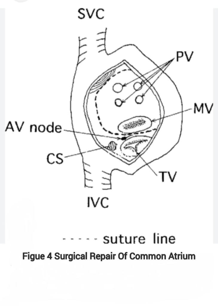 echocardiography
