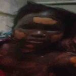 गुमला में गैस रिसाव से बड़ा हादसा, पत्नी की मौत, पति रिम्स के आईसीयू में भर्ती