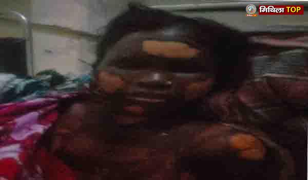 गुमला में गैस रिसाव से बड़ा हादसा, पत्नी की मौत, पति रिम्स के आईसीयू में भर्ती