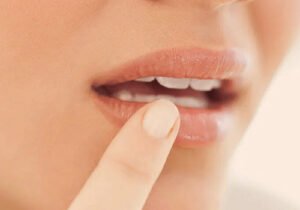 बार-बार मुंह के छाले क्यों होते हैं? जानिए कारण और घरेलू इलाज